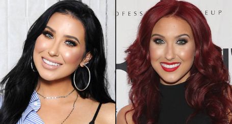 Jaclyn Hill before and after lips and nose filling.
